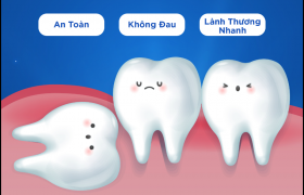 Răng Khôn Mọc Lệch Nguy Hiểm Nếu Không Điều Trị Sớm